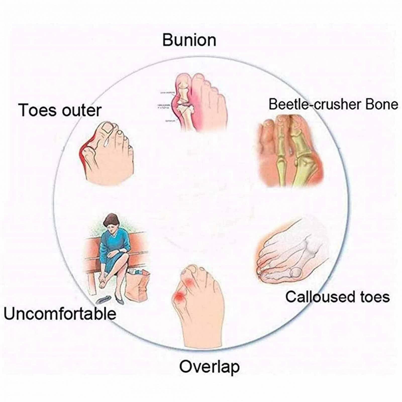 Женские ортопедические Шлепанцы Желтый, фото №4 Женские ортопедические Шлепанцы Желтый, фото №4