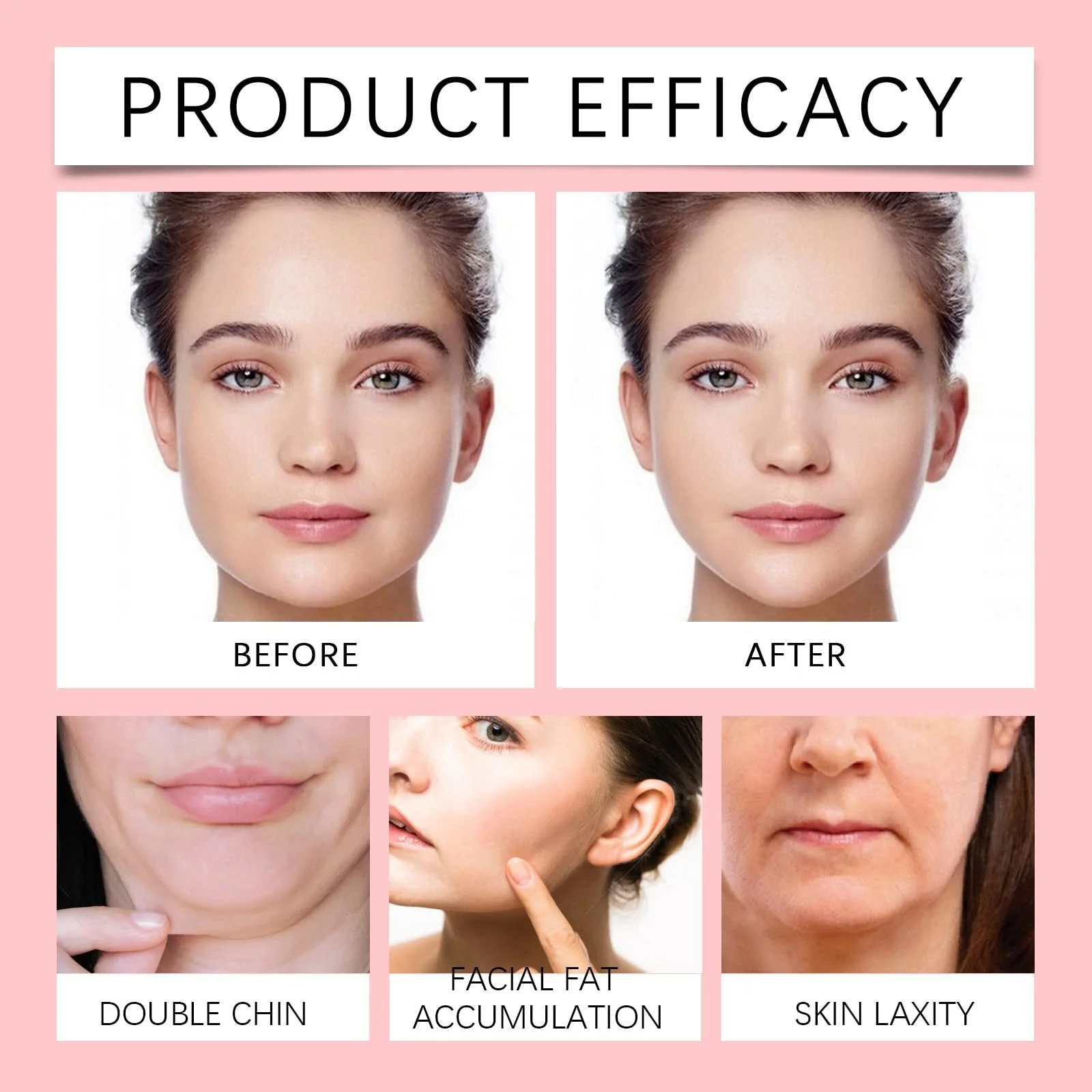 Маска для подтяжки V-зоны для подбородка (5 шт.), фото №5