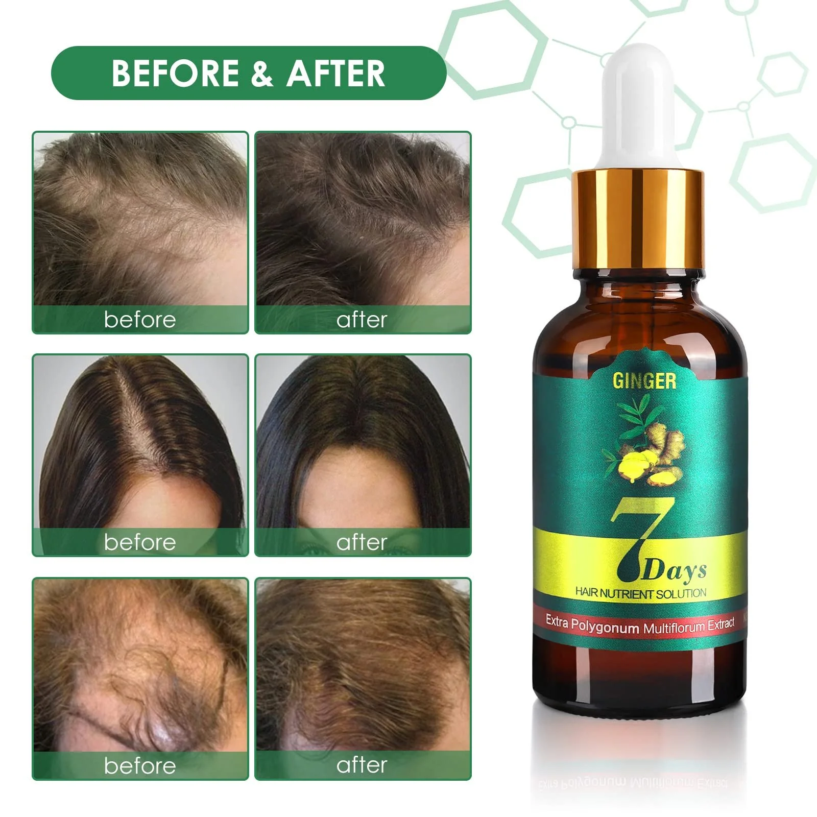 Сироватка для росту волосся Імбирна проти випадіння волосся для жінок і чоловіків (5 шт. в упаковці), фото №6