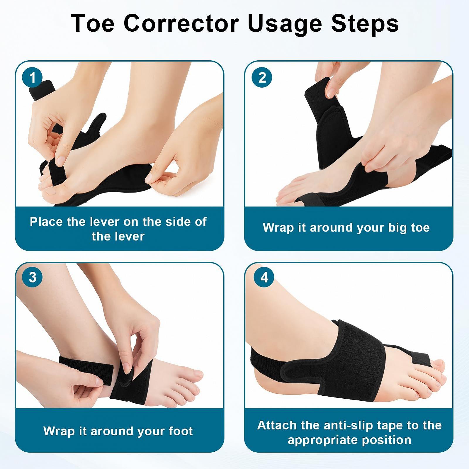 Шкарпетки-шини для корекції Hallux Valgus, 2 шт., для полегшення болю великого пальця, фото №7 Шкарпетки-шини для корекції Hallux Valgus, 2 шт., для полегшення болю великого пальця, фото №7