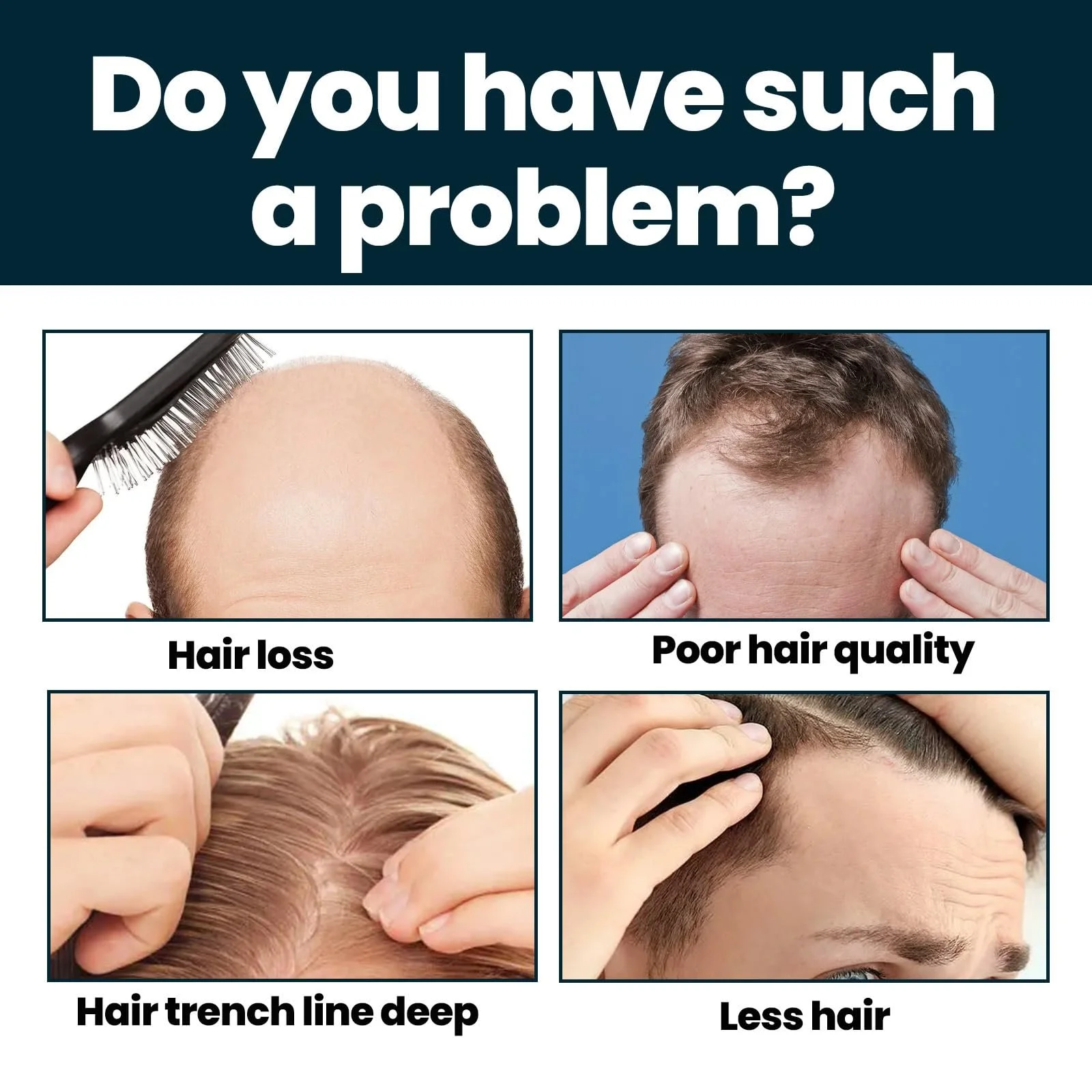 Сыворотка для роста волос, фото №3