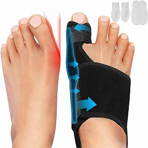 Корректор большого пальца стопы Hasny, 2 шины, 2 разделителя для пальцев - Фото 1