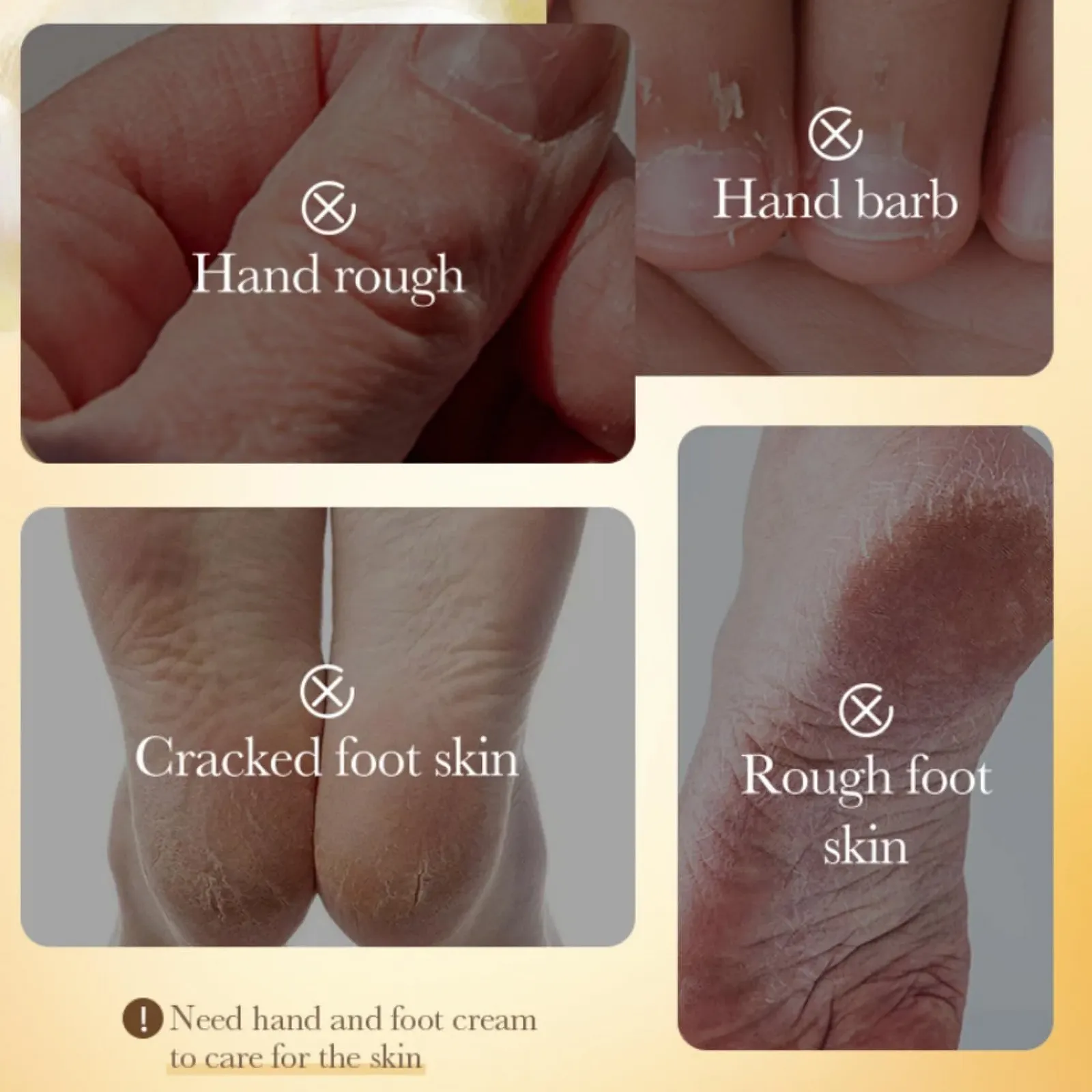 Крем-стик для ног Manuka Honey увлажняющий против трещин, фото №4 Крем-стик для ног Manuka Honey увлажняющий против трещин, фото №4