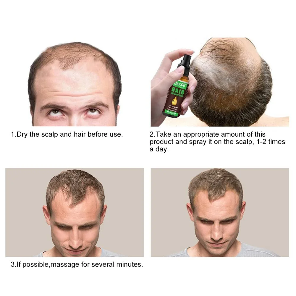 Спрей для росту волосся для стоншеного волосся 60 мл, фото №6