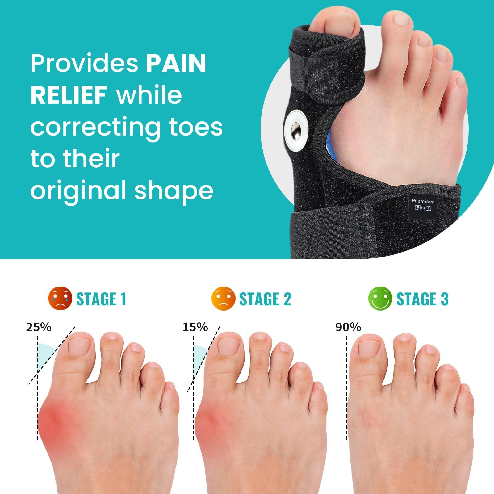 Коректор великого пальця стопи для жінок і чоловіків 1 пара шин для корекції вальгусної деформації регульований, фото №2 Коректор великого пальця стопи для жінок і чоловіків 1 пара шин для корекції вальгусної деформації регульований, фото №2