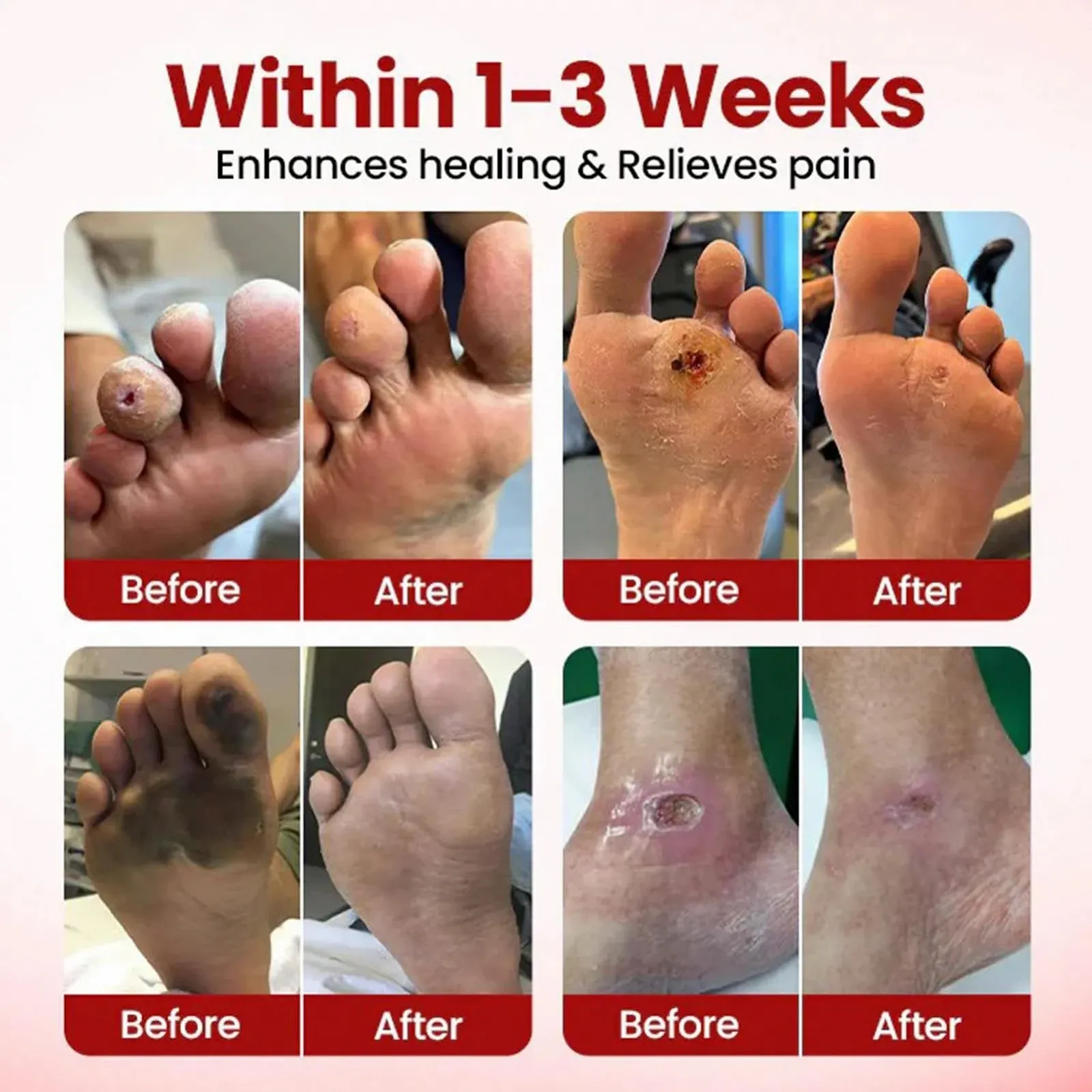 Крем для ног Cracked Feet увлажняющий для сухой и потрескавшейся кожи для мужчин и женщин, фото №4