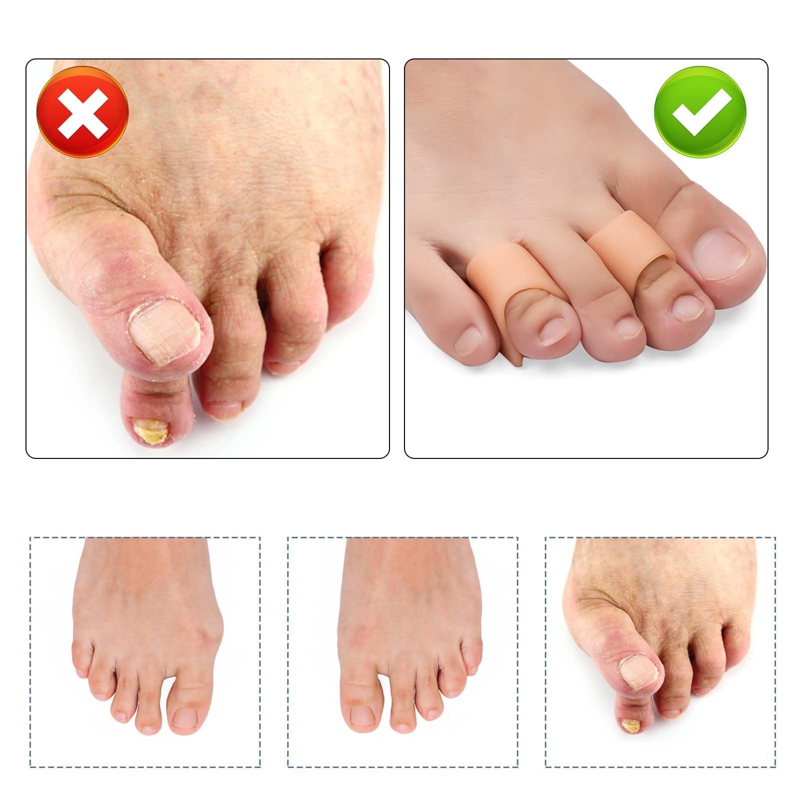 Випрямлячі для пальців ніг 6 шт., М’який гелевий коректор для випрямлення кривих пальців ніг (3 розміри), фото №3