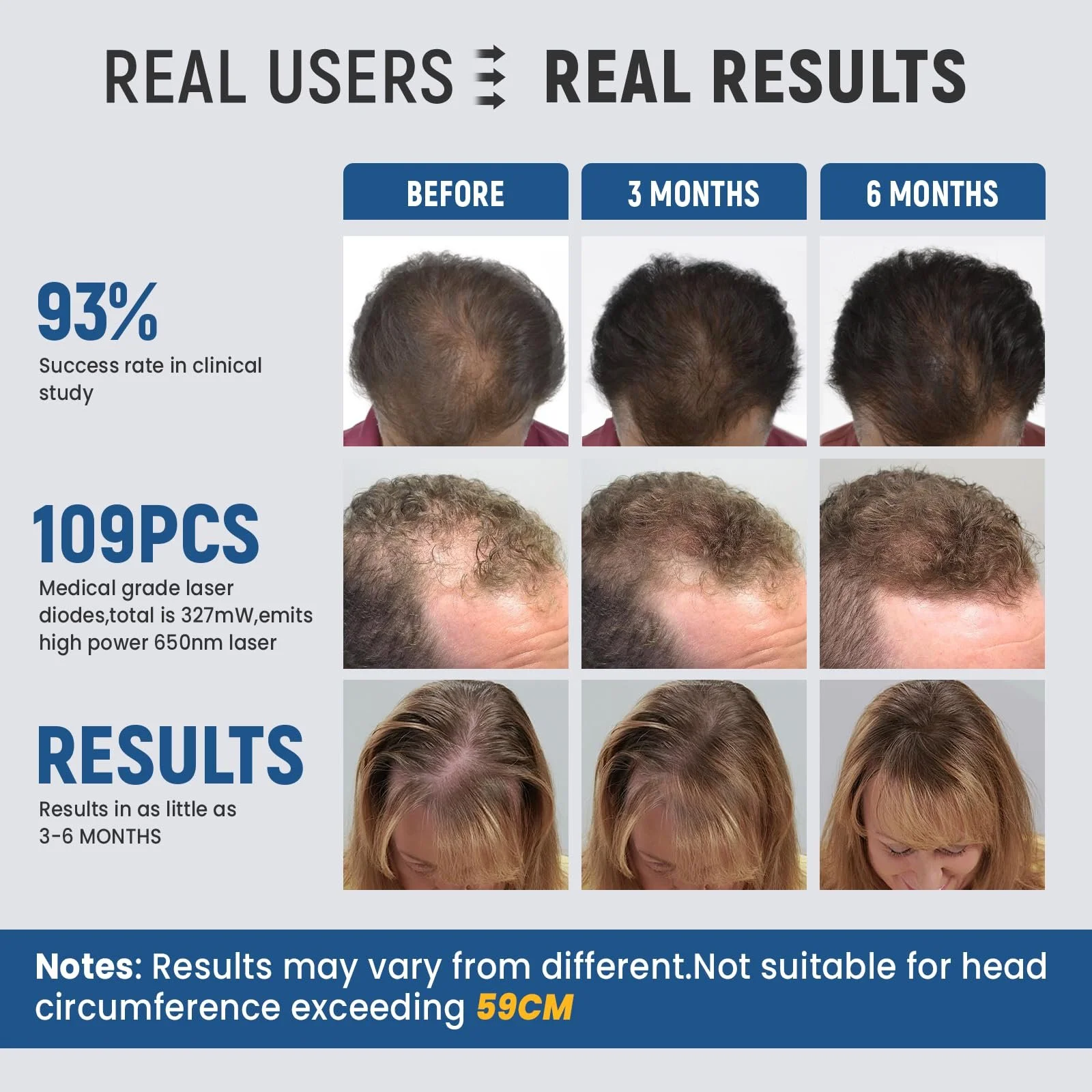 Шолом Лазерний iKeener lllt для росту волосся 109 лазерних діодів 650 нм, фото №2