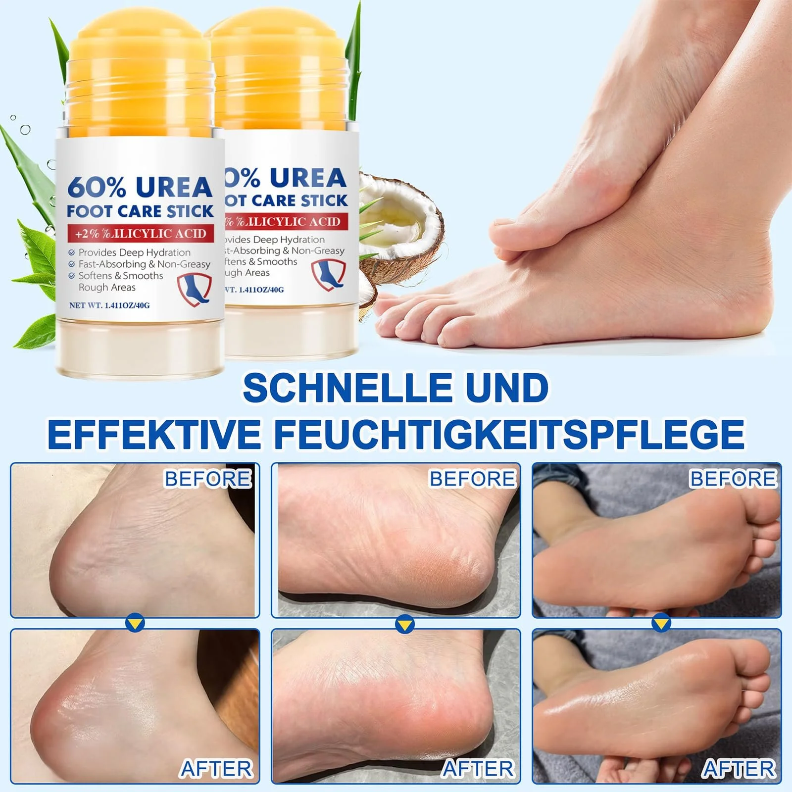 Крем для ног Urea Cream 60% увлажняющий против трещин 2 шт., фото №2