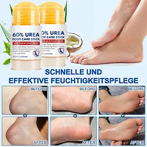 Крем для ног Urea Cream 60% увлажняющий против трещин 2 шт. synthetic.ua - Фото 1