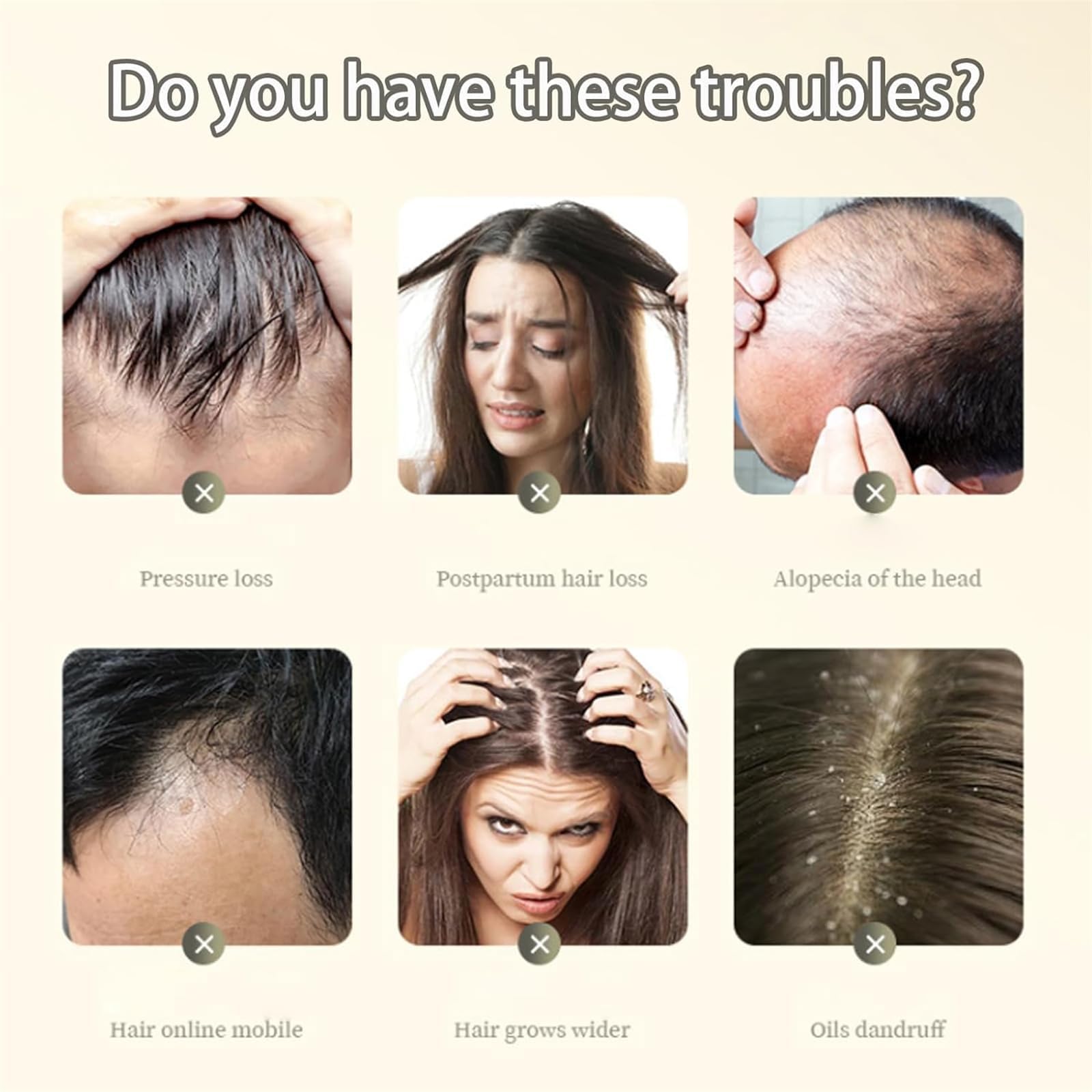Шампунь HIDRUO Ginger Plant Extract Anti-Hair Loss Ginger для всіх типів волосся (1 шт.), фото №2