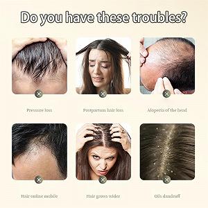 Шампунь HIDRUO Ginger Plant Extract Anti-Hair Loss Ginger для всіх типів волосся (1 шт.) synthetic.ua - Фото 1