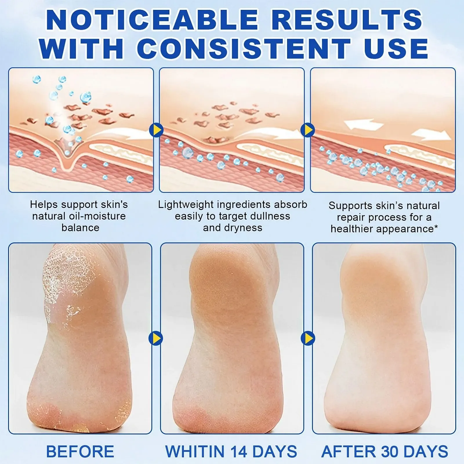 Крем-стик для ног Urea Cream 60% увлажняющий от трещин с 2% кислотой 2 шт, фото №7