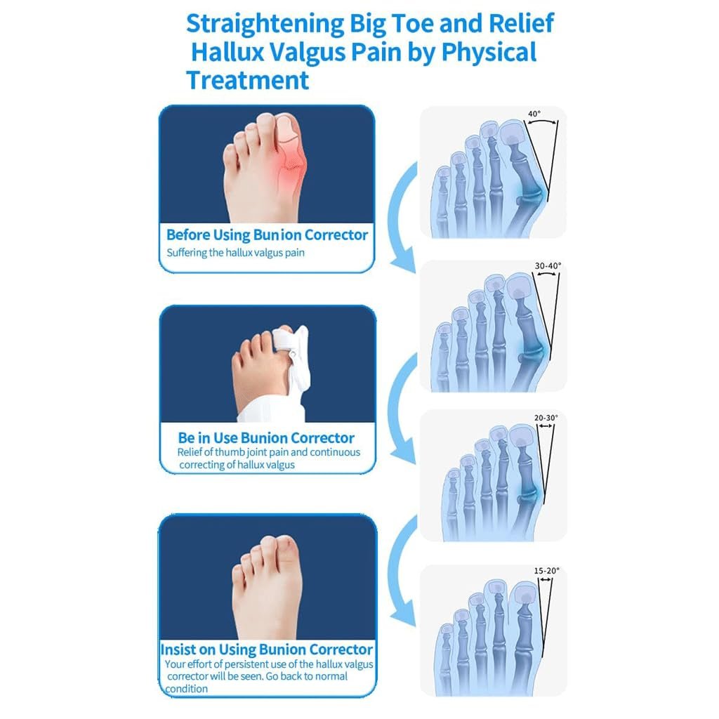 Ортез великого пальця стопи Регульований, фото №3