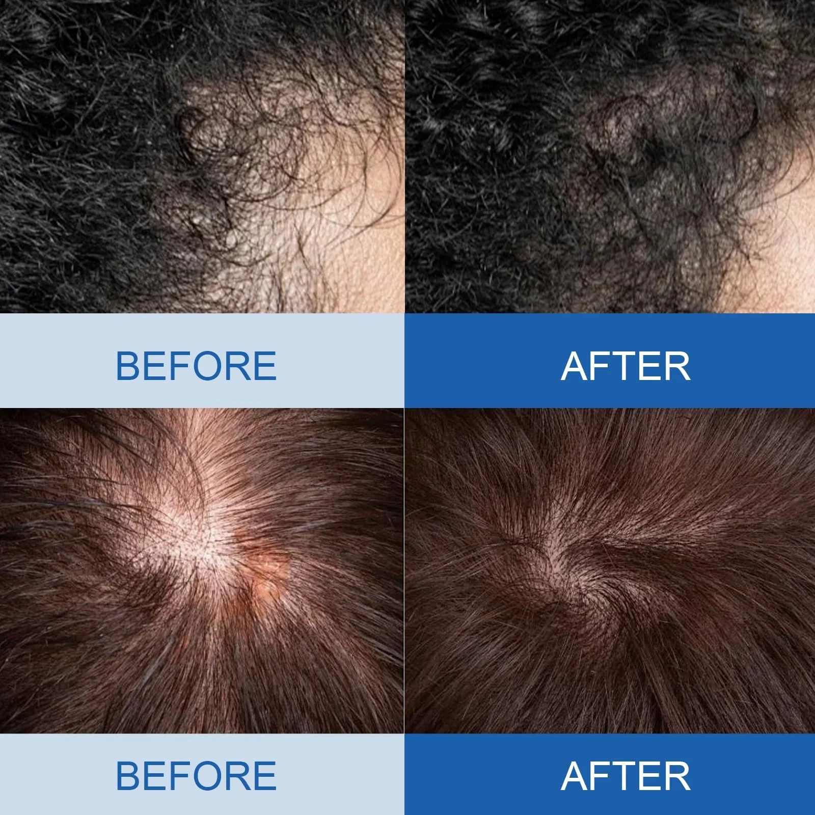 Засіб для росту волосся Натуральний 60 мл для чоловіків і жінок, фото №6