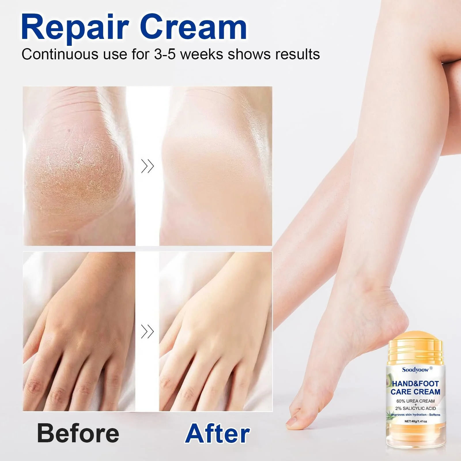 Крем для ног soodyoow с 60% мочевины и салициловой кислотой, 2 х 40 г, фото №3