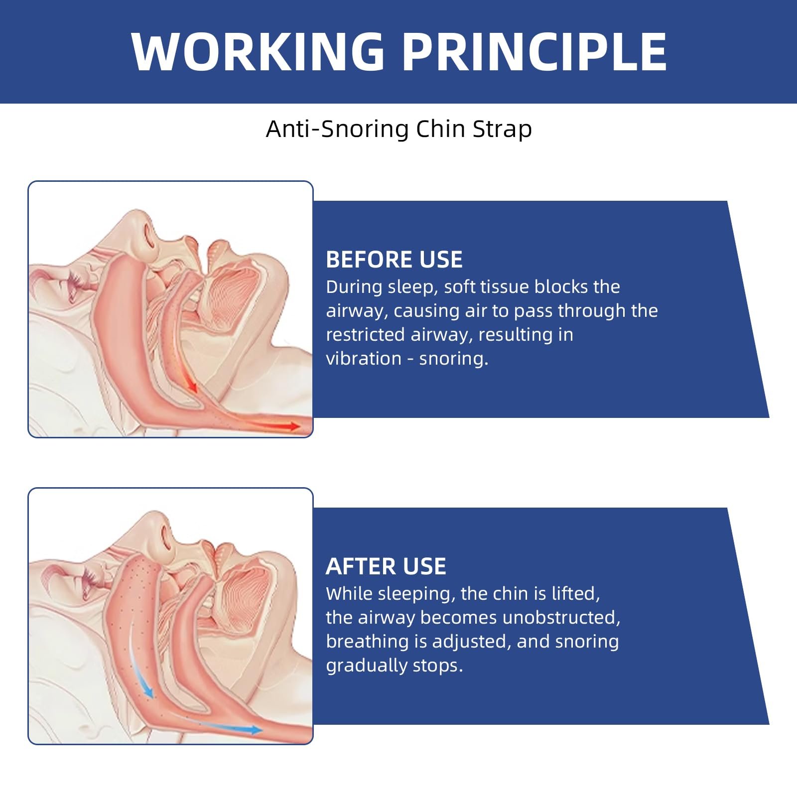 Ремешок на подбородок против храпа Регулируемый для улучшения сна, фото №4