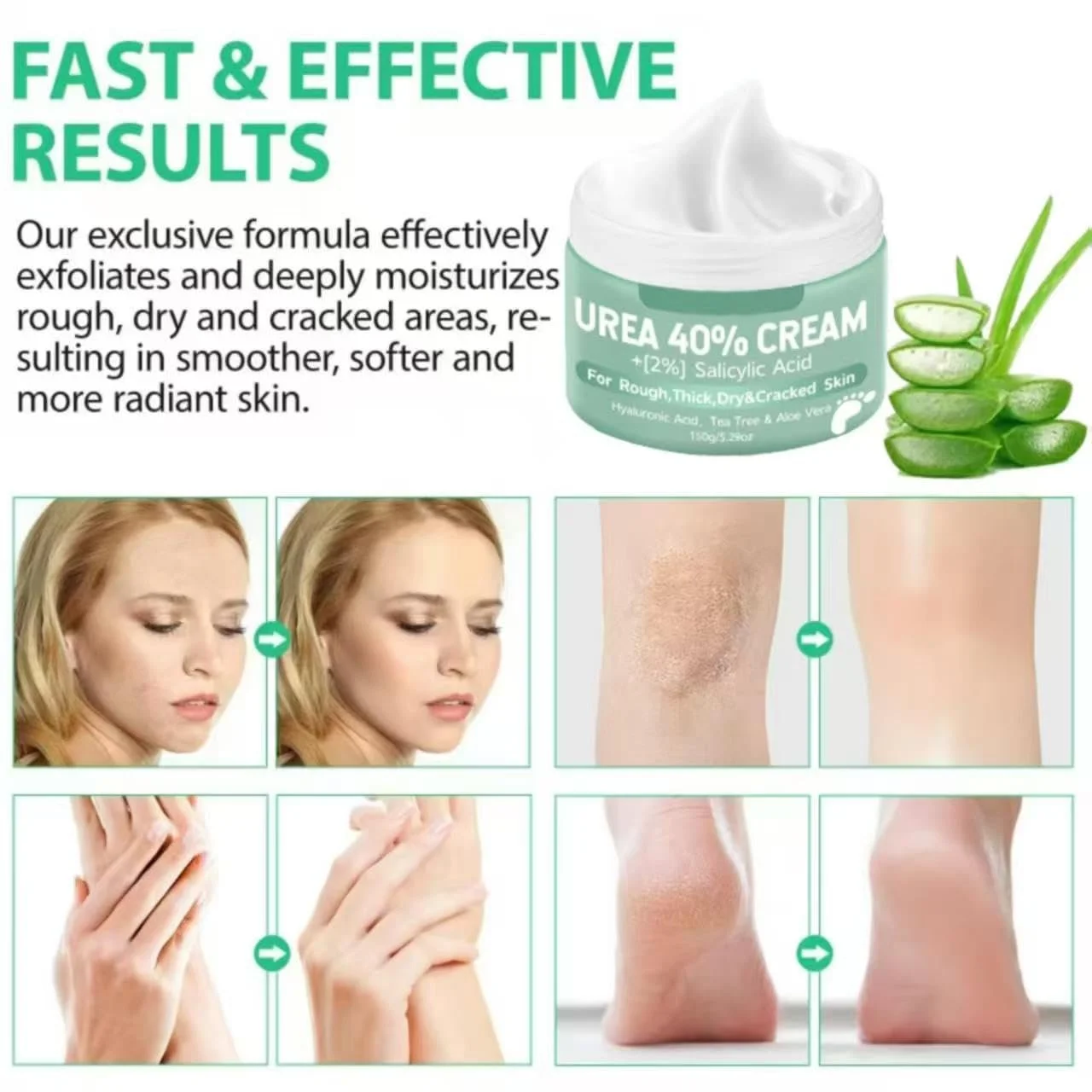 Крем для ног Urea 40% для сухой и потрескавшейся кожи локтей, коленей и рук 150 г, фото №4