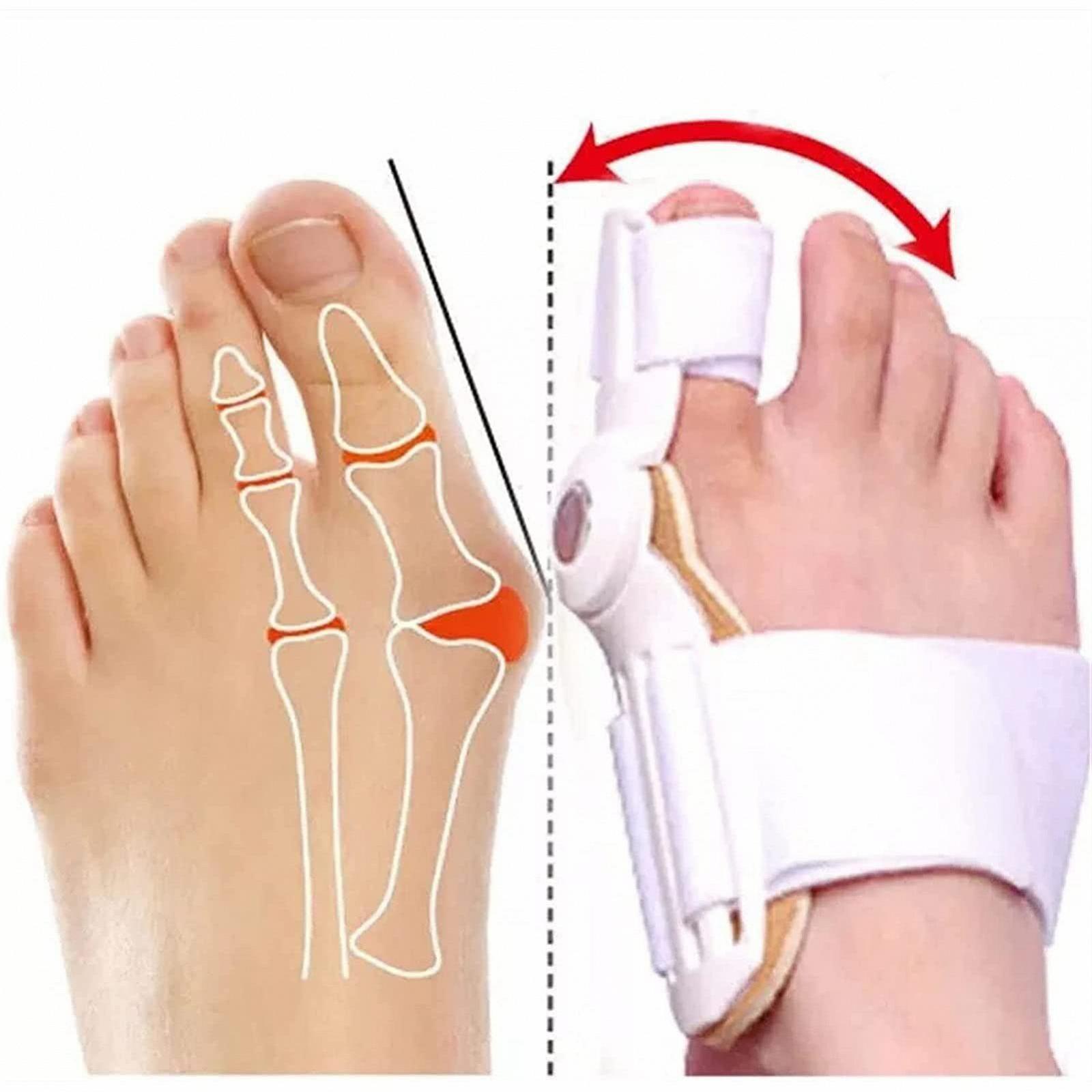 Корректор большого пальца стопы для женщин и мужчин., фото №8 Корректор большого пальца стопы для женщин и мужчин., фото №8
