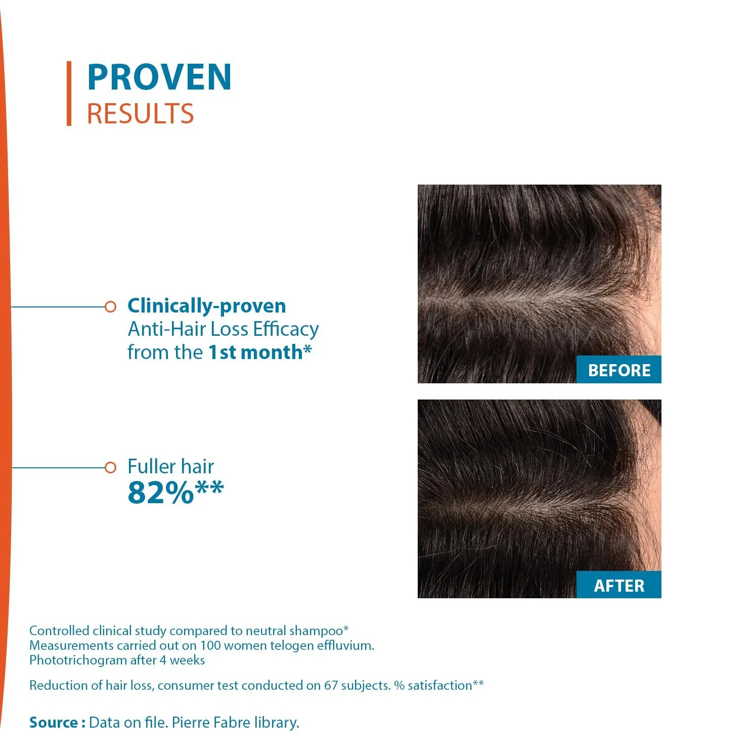 Лосьон против выпадения волос Ducray Creastim Reactiv 60 мл, фото №5