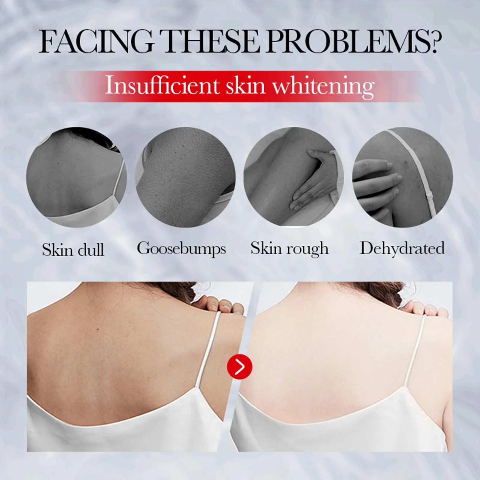 Лосьйон для тіла з койєвою кислотою для відбілювання шкіри, фото №7