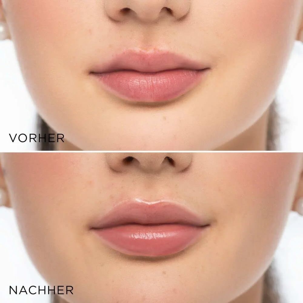 Блиск для губ Artdeco Glossy Lip Volumizer Rosa 6 мл, фото №3 Блиск для губ Artdeco Glossy Lip Volumizer Rosa 6 мл, фото №3