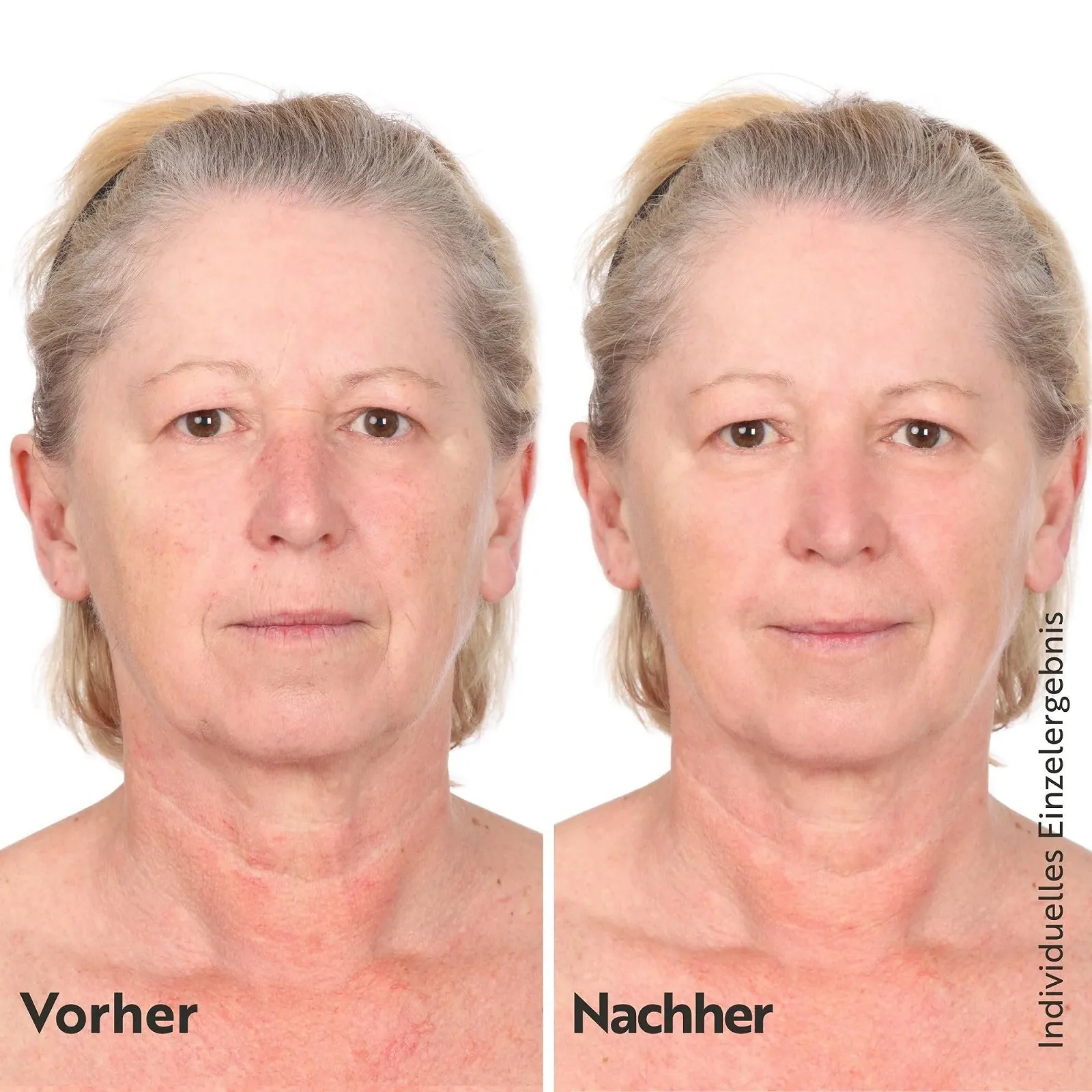Крем для обличчя M. Asam Collagen Lift 24h зволожувальний веганський з рослинним колагеном та олією ши 50 мл, фото №3