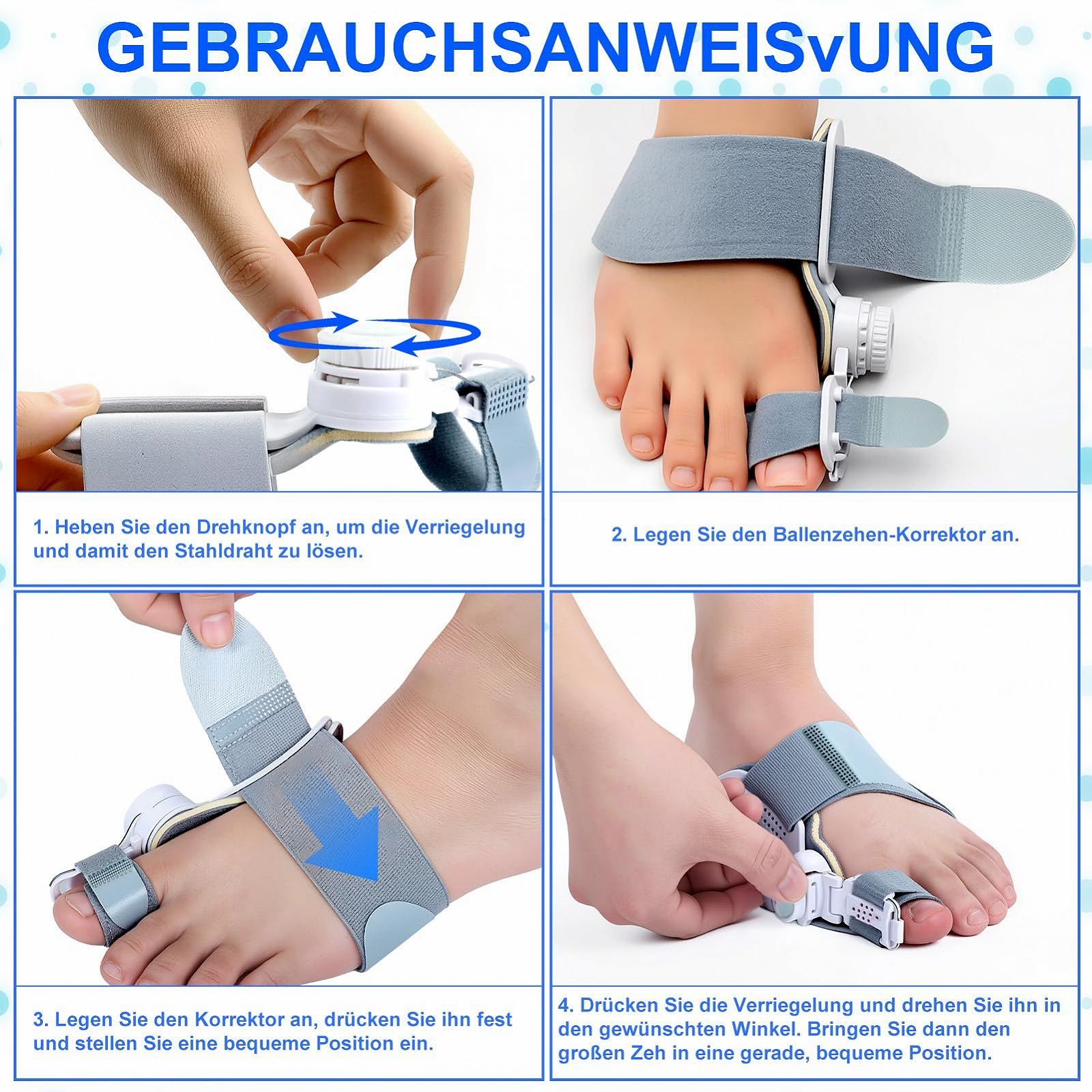 Корректор Hallux Valgus, Регулируемая шина Hallux Valgus для дня и ночи, уменьшает боль и нагрузку, фото №5