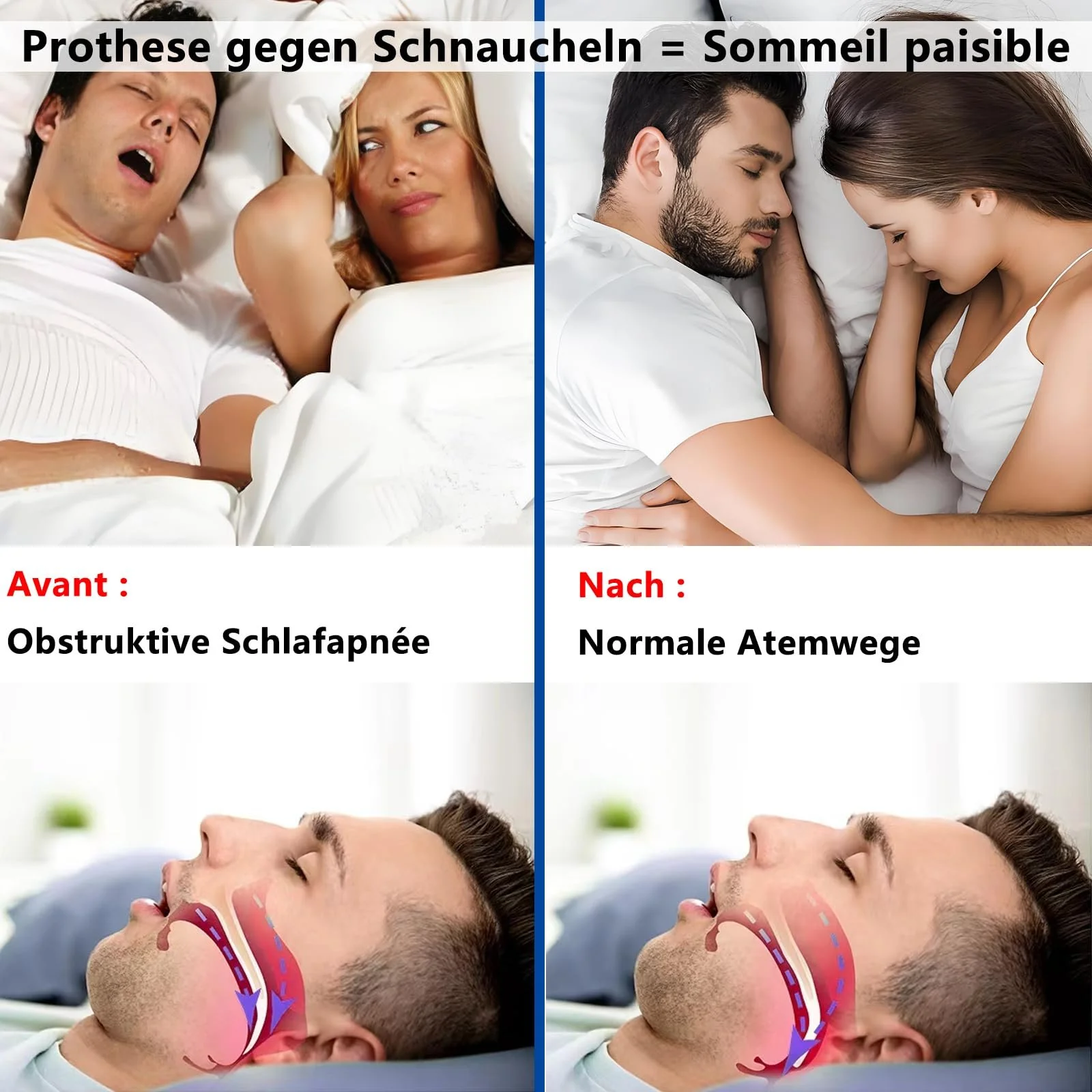 Засіб від хропіння Комфортна шина проти хропіння для чоловіків, фото №2 Засіб від хропіння Комфортна шина проти хропіння для чоловіків, фото №2
