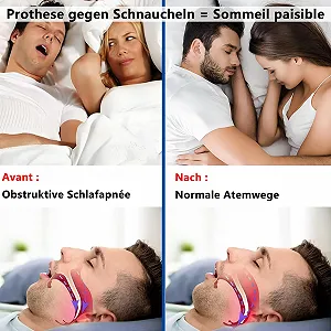 Засіб від хропіння Комфортна шина проти хропіння для чоловіків synthetic.ua - Фото 1
