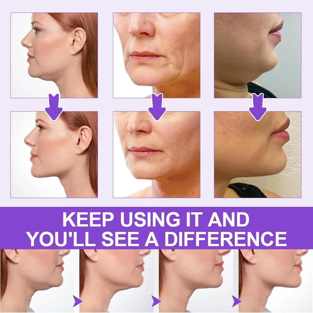 Набор лент для подтяжки лица GGUFAY, 20 штук + 4 подъемных шнура, фото №5