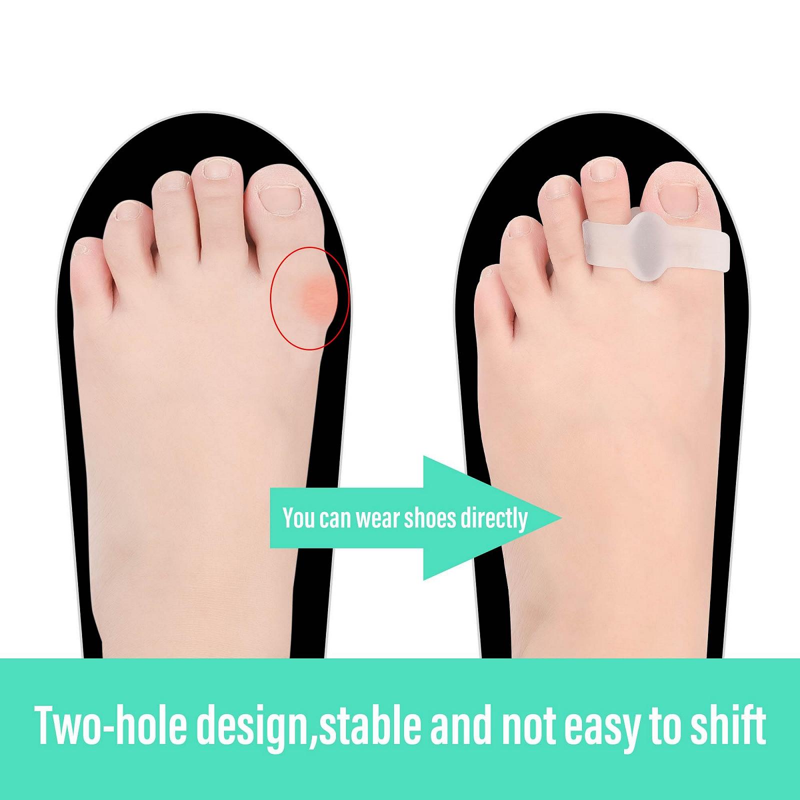 Роздільник для пальців 6 x Коректор вальгусної деформації, фото №5 Роздільник для пальців 6 x Коректор вальгусної деформації, фото №5