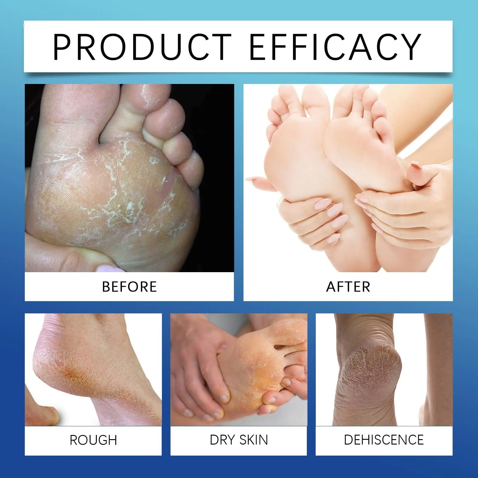 Набор кремов для ног увлажняющих с мочевиной против трещин и сухости 2 шт, фото №6