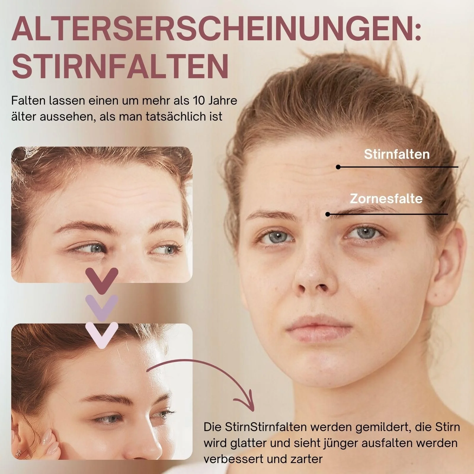 Пластирі проти зморшок Anti-Ageing з гіалуроновою кислотою для лоба, 60 шт, фото №3