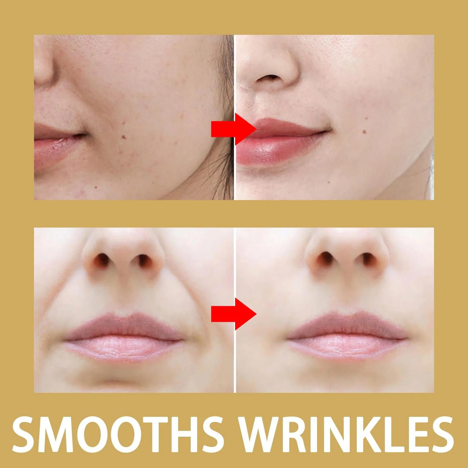 Набір пластирів від зморшок (6 шт.) та наклейок від зморшок на ніс (6 шт.), фото №3 Набір пластирів від зморшок (6 шт.) та наклейок від зморшок на ніс (6 шт.), фото №3