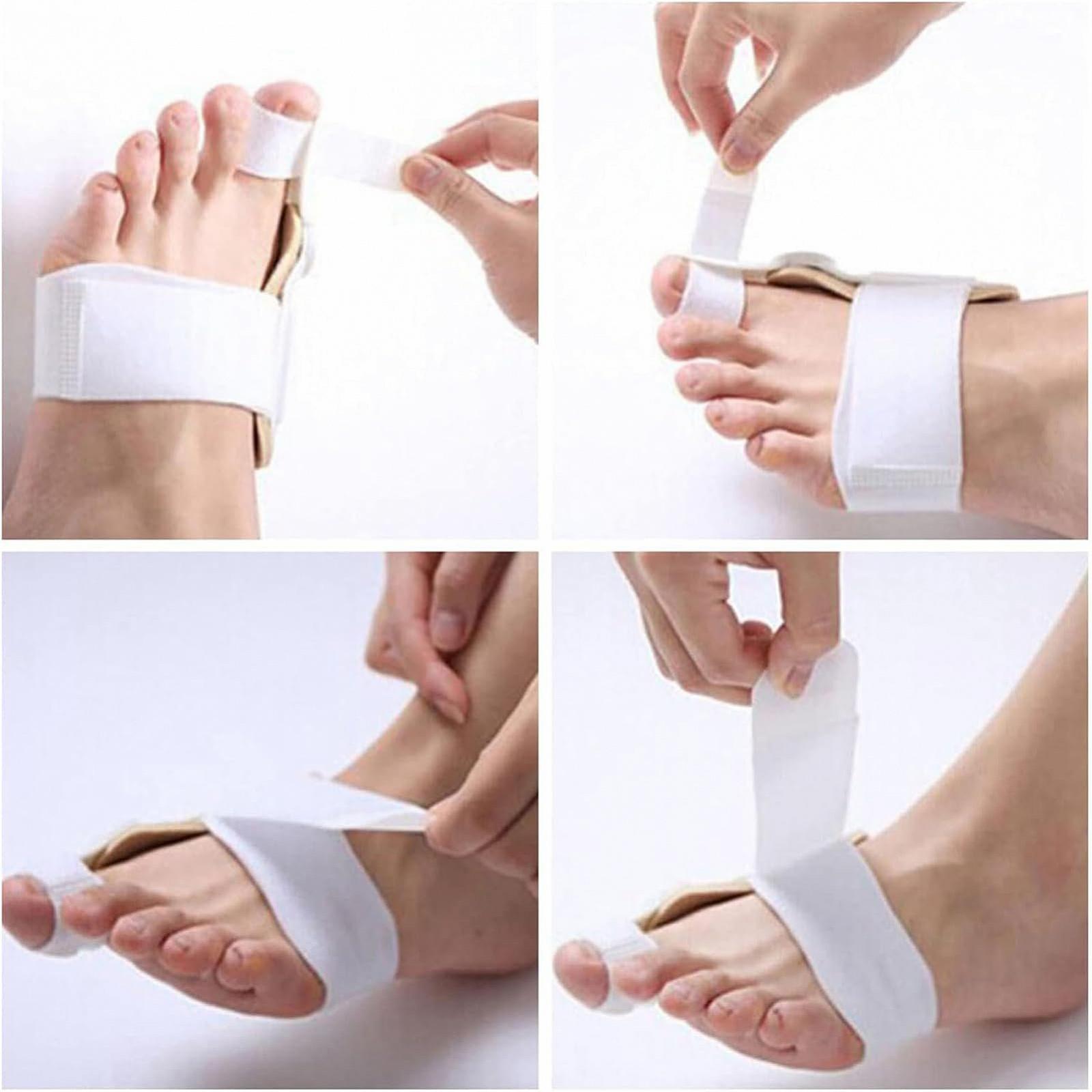 Коректор Вальгусної Деформації (2 шт.) Регульований Розмір для Чоловіків та Жінок, фото №7