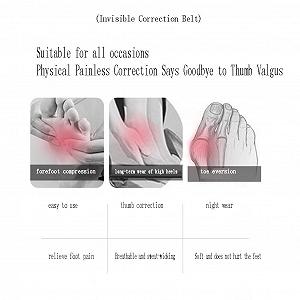 Коректор великого пальця стопи CAZARU Hallux Valgus, регульований розмір, для чоловіків і жінок, денна і нічна підтримка synthetic.ua - Фото 1