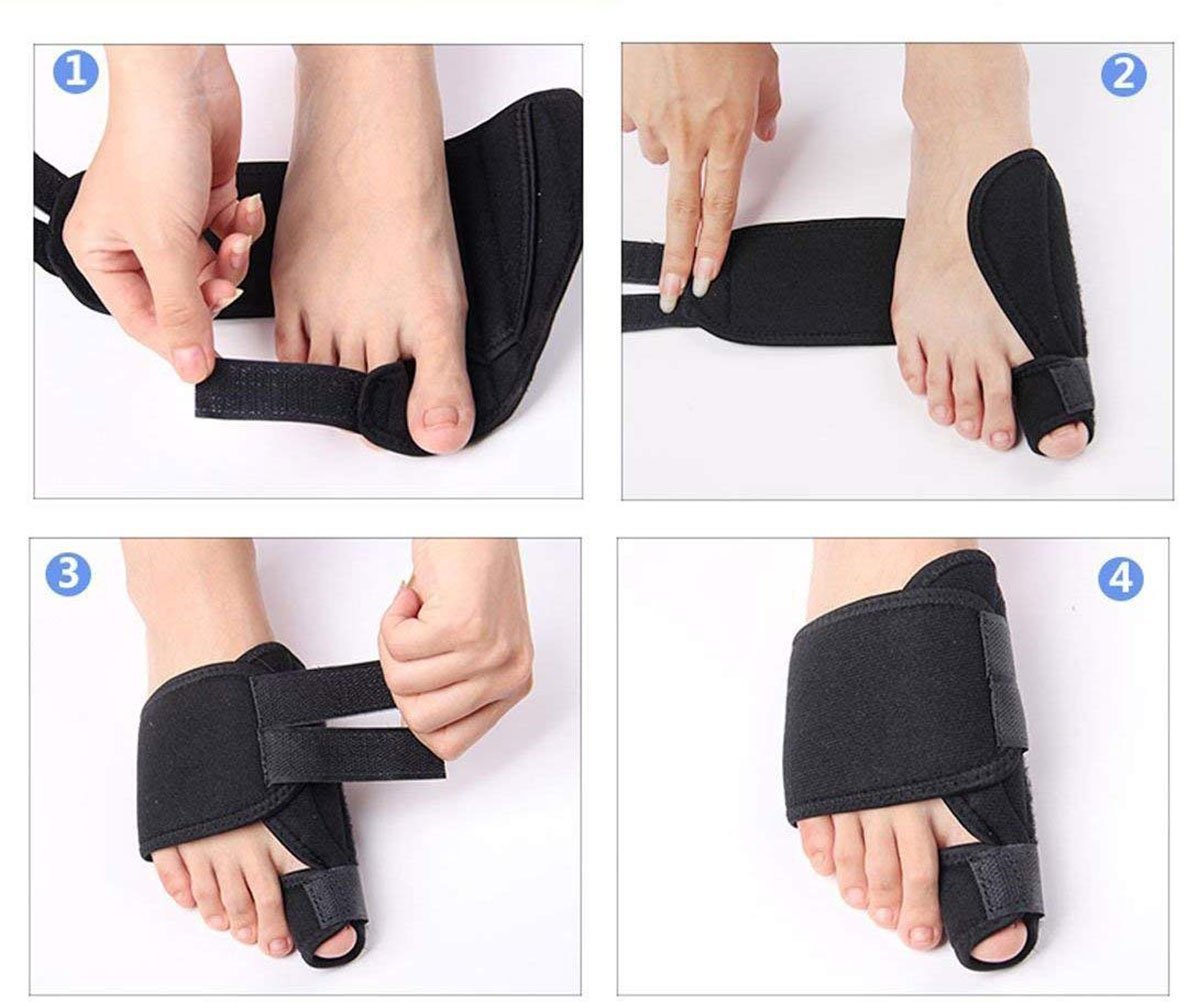 Шина для великого пальця стопи PEDIMENDTM для полегшення болю при вальгусній деформації (2 пари), фото №7