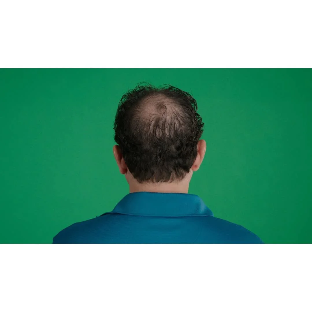 Лосьйон Velform Hair Grow Max для стимуляції росту волосся, 1 флакон 200 мл, фото №6 Лосьйон Velform Hair Grow Max для стимуляції росту волосся, 1 флакон 200 мл, фото №6