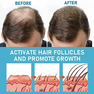 Сыворотка для роста волос 60 мл synthetic.ua - Фото 1