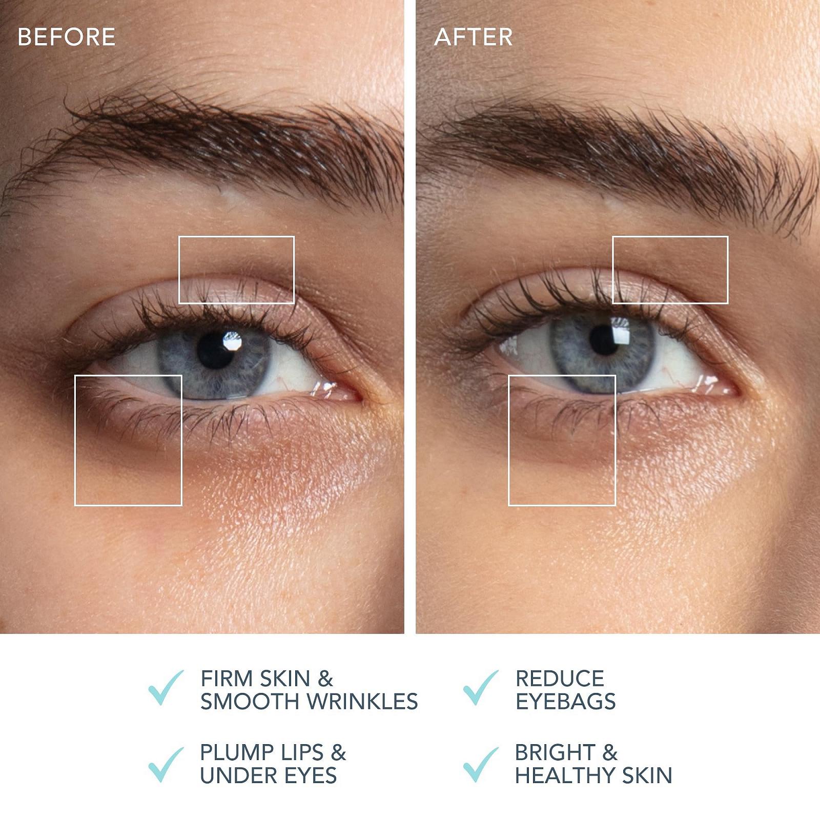 Масажер FOREO Bear 2 Eyes & Lips для підтяжки обличчя, для очей та губ, проти зморшок, арктичний синій, фото №5