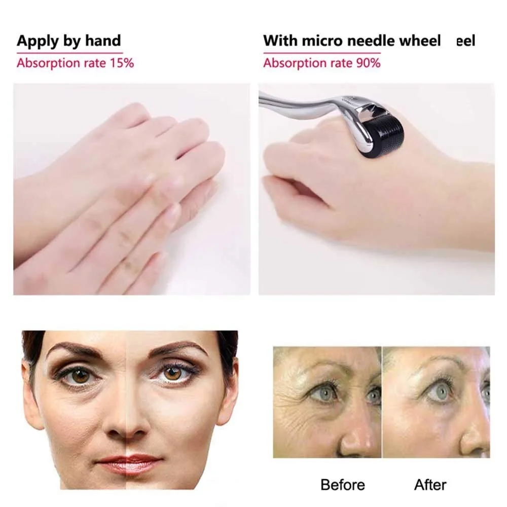 Дермароллер 540 голок 0.3 мм Нержавіюча сталь Чорний/Фіолетовий, фото №2