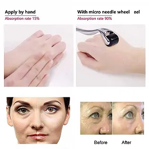 Дермароллер 540 голок 0.3 мм Нержавіюча сталь Чорний/Фіолетовий synthetic.ua - Фото 1