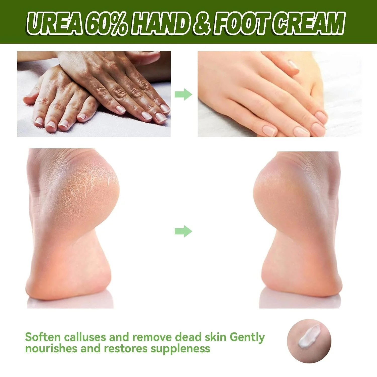 Крем для ног Hydrating and Anti-Cracking увлажняющий от трещин и сухости, фото №7