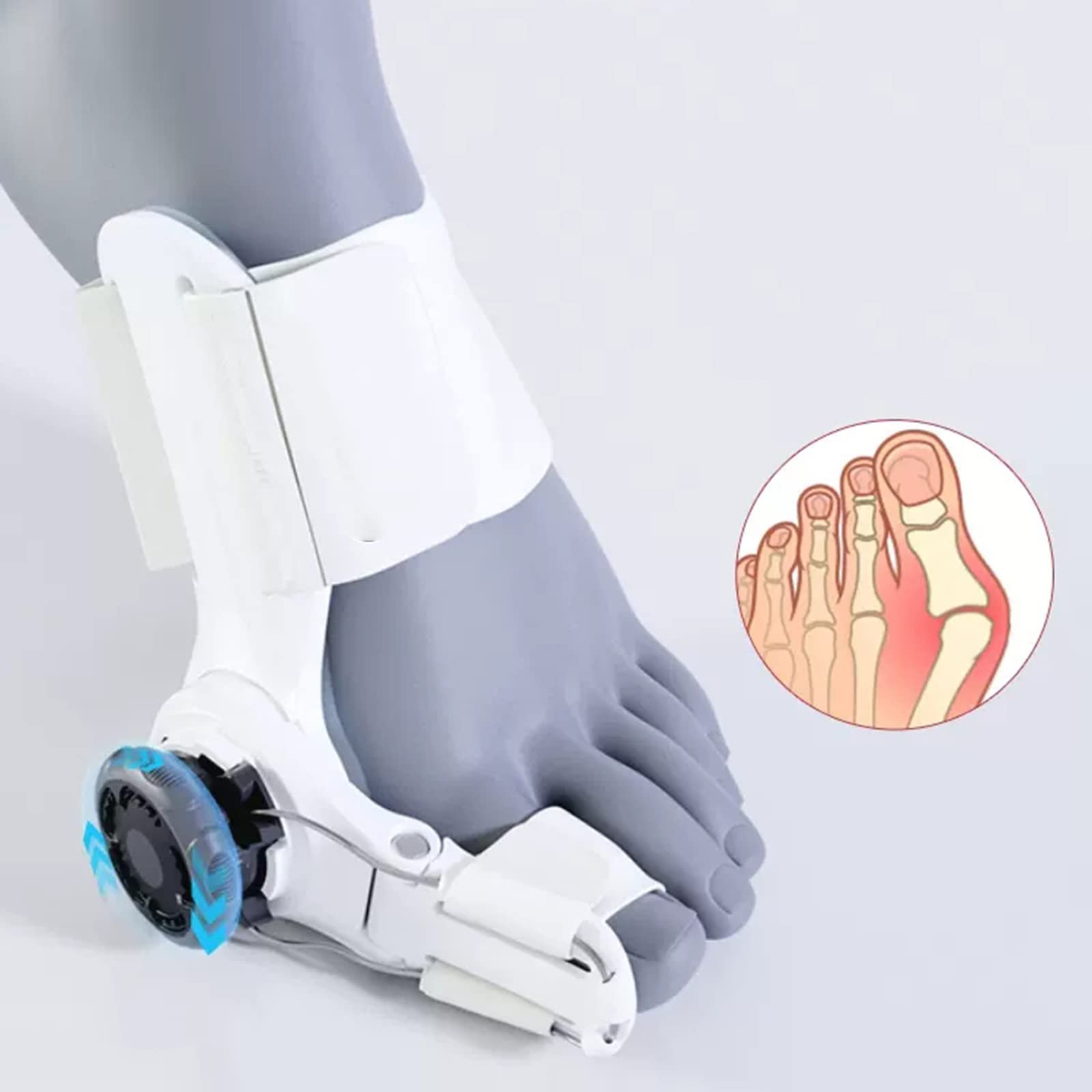 Коректор вальгусної деформації, ортопедичний для великого пальця ноги з 3D кнопкою, регулюванням кута, точною шкалою, гнучким обертанням на 180, фото №6