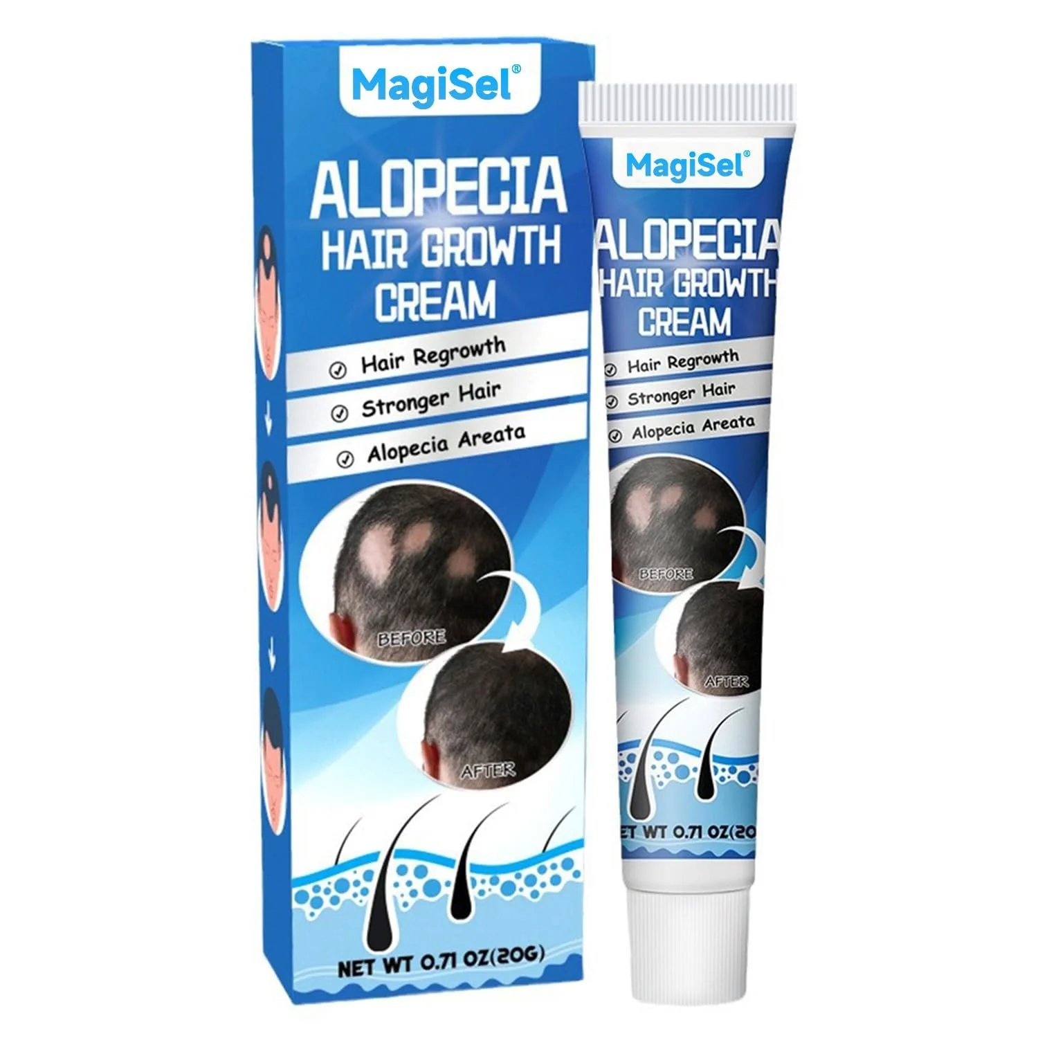 Крем против выпадения волос Cream, 20 г, ускоряет рост волос, эссенция для ухода за волосяными фолликулами, эффективный рост волос, фото №1