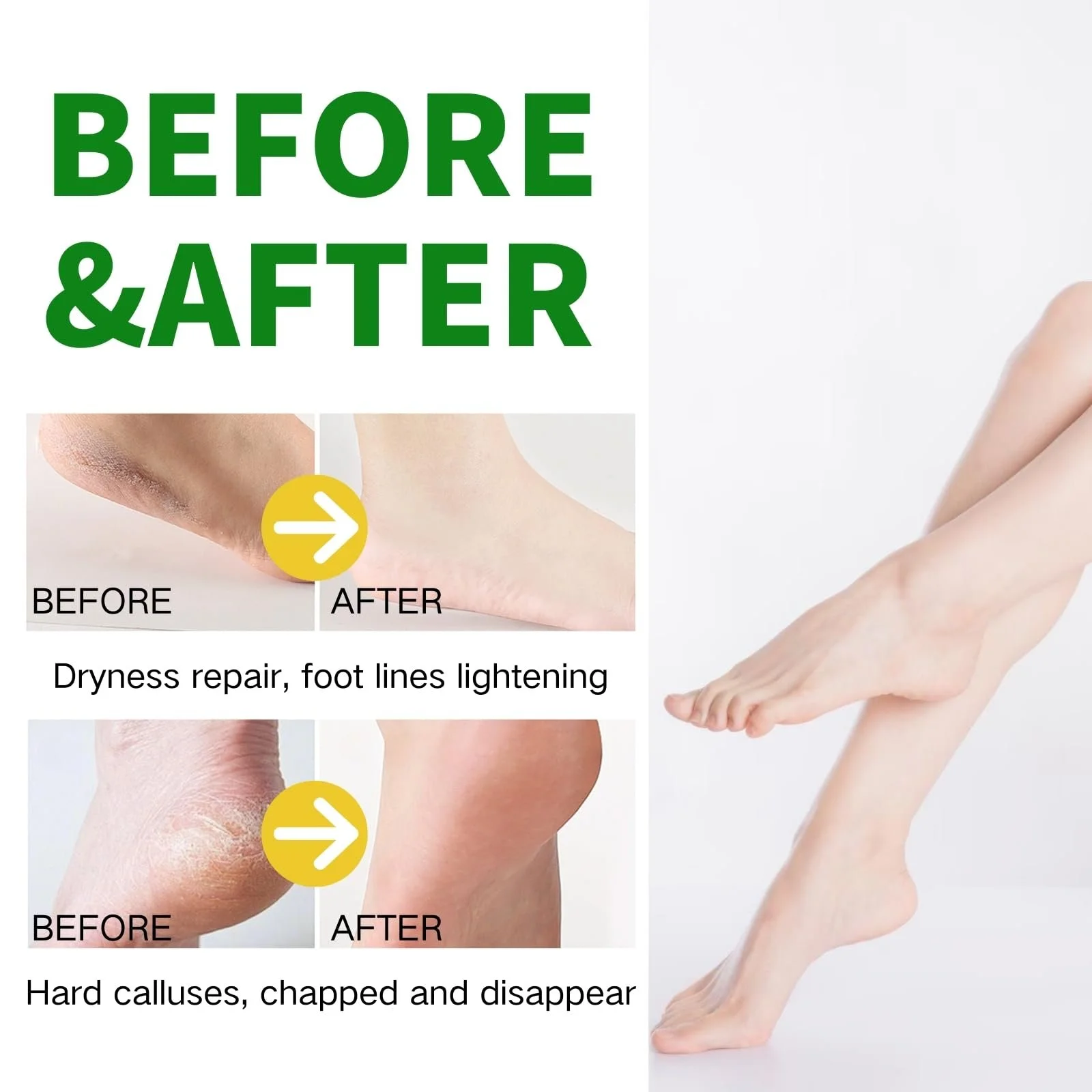 Крем для ног с мочевиной 60% против мозолей и трещин интенсивный, фото №6