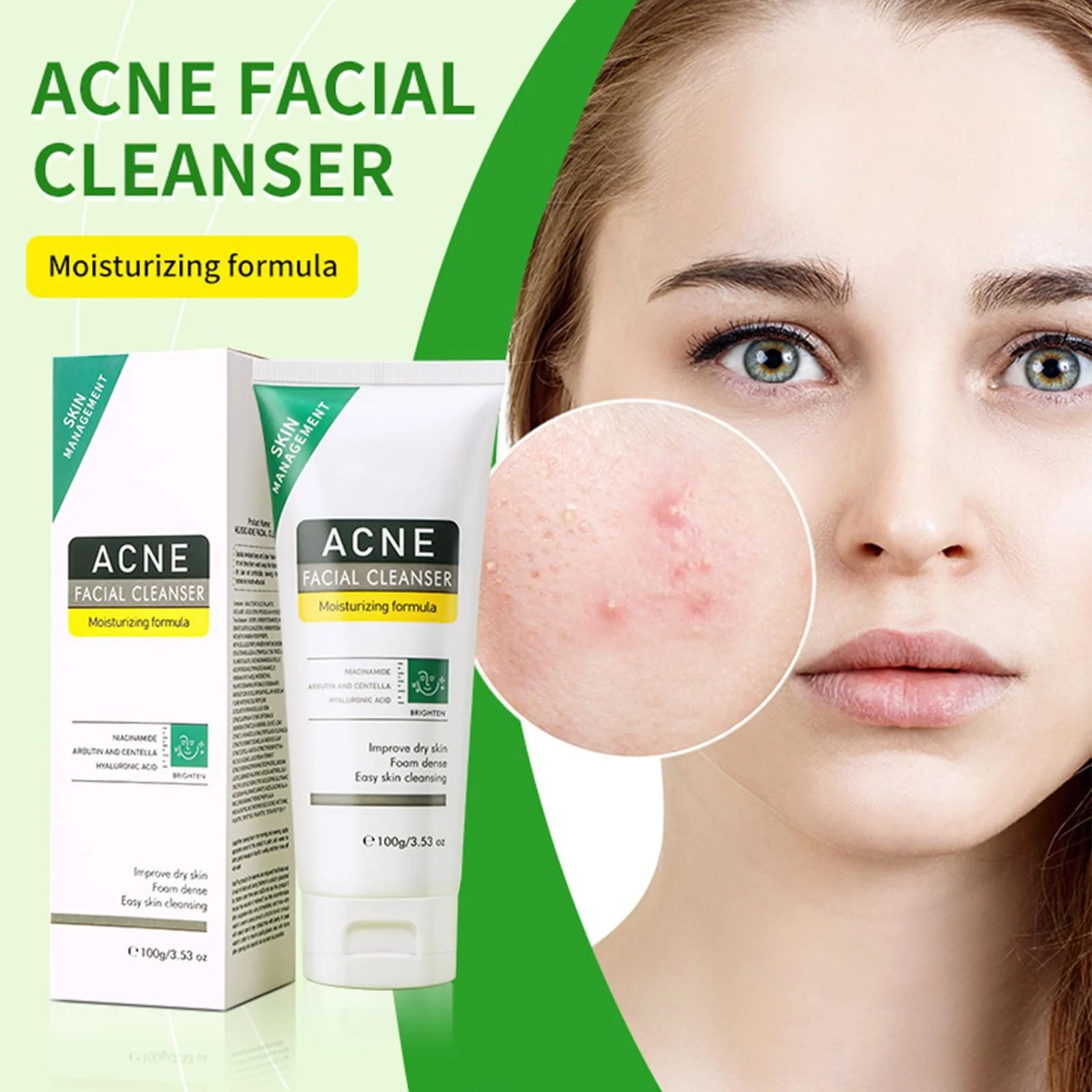 Засіб для вмивання від акне, контролює надлишковий жир, помітно зменшує прищі та чорні цятки, фото №7