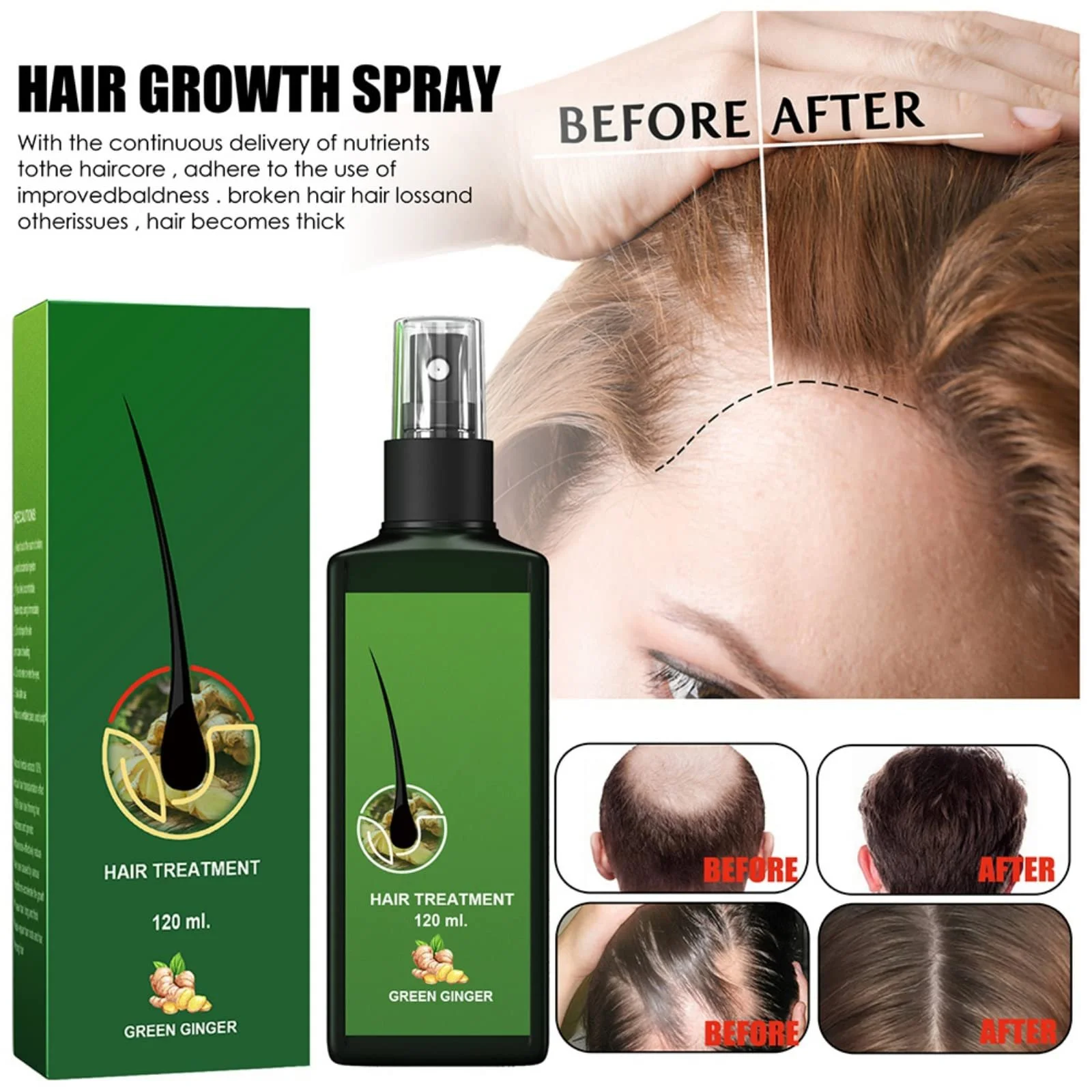 Сироватка для росту волосся Qiaogeli для стоншеного волосся, фото №3 Сироватка для росту волосся Qiaogeli для стоншеного волосся, фото №3