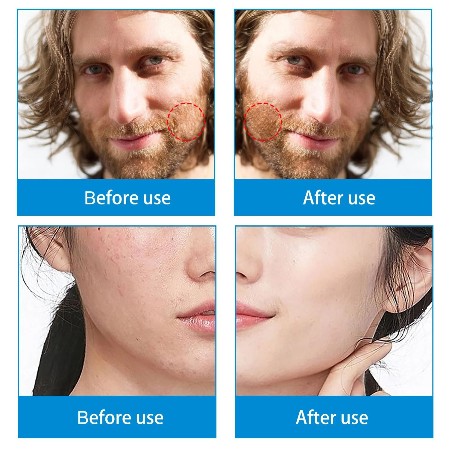 Дермаролер NXPUXP 0,5 мм (V2), фото №5